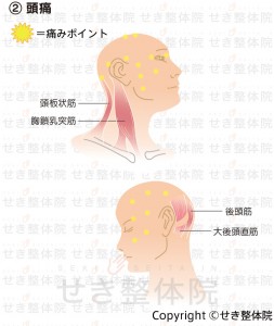 頭痛