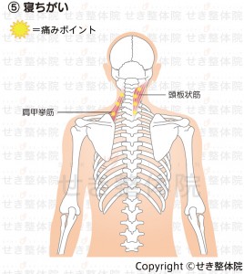 寝ちがい