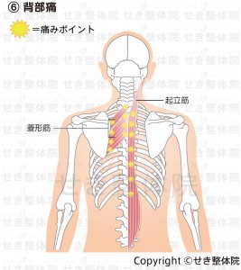 背部痛