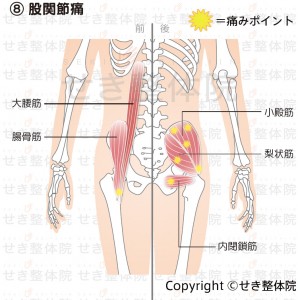 股関節痛