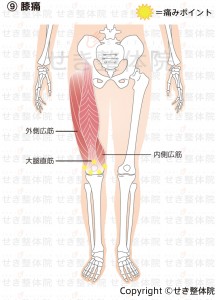 膝痛