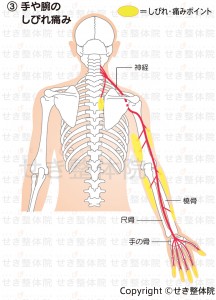 手や腕のしびれ