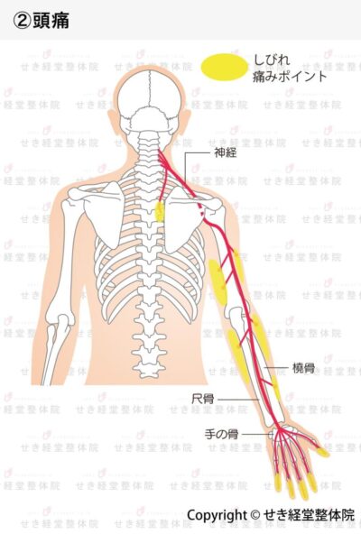 手や腕のしびれ