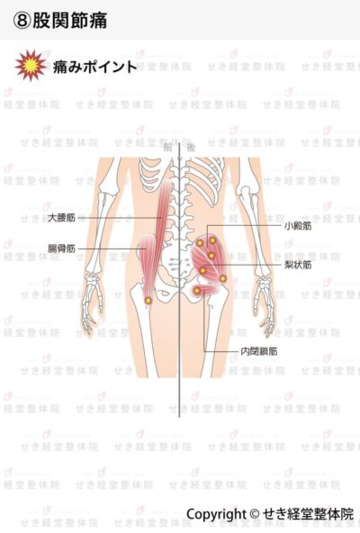 股関節痛